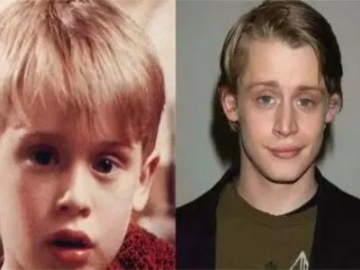 這些讓你變丑的習(xí)慣，再不改那可就沒救了！