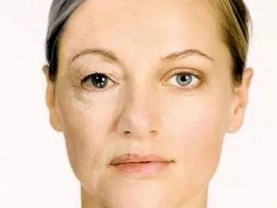 卸妝減少的肌膚問題，比你的護膚產品有用多了