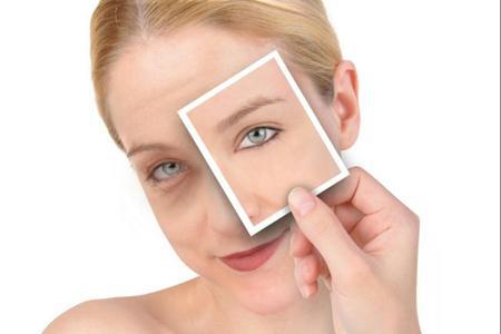 水腫、黑眼圈只是因為沒睡好？女性眼部問題潛藏的病癥