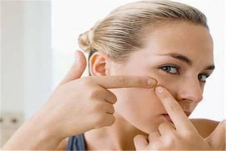 青春期女性長痘必非小事？可能要面臨的問題以及建議性護膚法