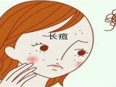 青春期女性長(zhǎng)痘必非小事？可能要面臨的問(wèn)題以及建議性護(hù)膚法