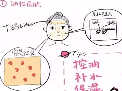 你是干性還是油性肌膚，膚質不同護膚措施也不同