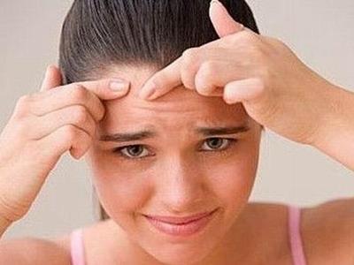 女生額頭長痘的原因，對癥下藥才能有干凈肌膚