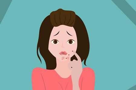 女性下巴長痘，原來是身體這里出問題，教你五招去除痘痘