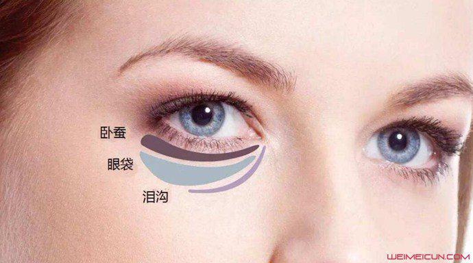 怎樣去除眼袋最有效的方法是什么 幾個實用小妙招推薦-易網<a href=http://www.logojc.com/ target=_blank class=infotextkey>健康養生</a>網 怎樣去除眼袋最有效的方法是什么 幾個實用小妙招推薦