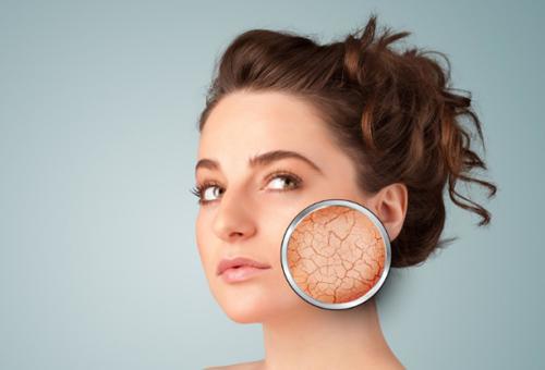 臉上紅血絲怎么引起的 改善紅血絲的方法有哪些？