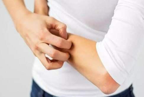 冬季皮膚瘙癢是怎么回事? 可能是6個因素在作怪