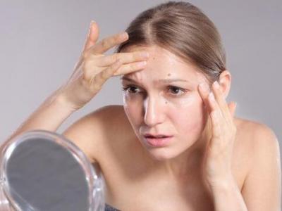 面部頻繁起痘是怎么回事？這4個原因要注意