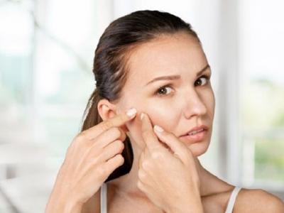 為什么不能用手?jǐn)D痘痘？用手?jǐn)D痘痘的危害