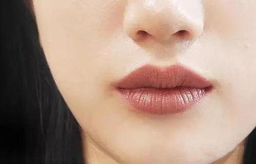 嘴唇邊緣顏色深如何淡化？淡化唇色的方法