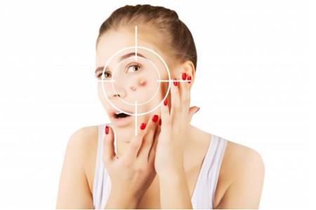 膿包型痤瘡的護(hù)理方法，教你六招修復(fù)皮膚