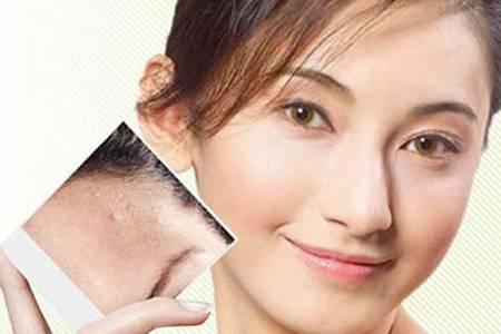 祛痘印最好的六個(gè)方法，女生淡化痘印效果看得見(jiàn)