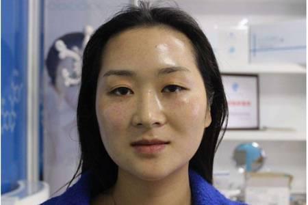 玻尿酸原液的作用和使用方法，女性天天用玻尿酸的后果