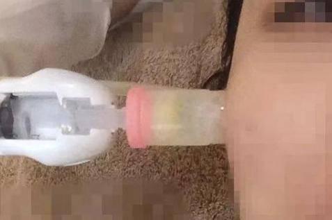 微針和水光針有什么區(qū)別？哪個治療效果會更好