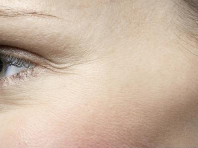 怎樣消除眼部細紋 做到這幾點有效改善細紋