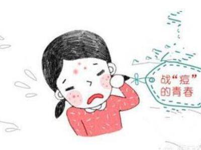 臉上長痘痘的原因，詳說青春期的女生有哪些祛痘方法