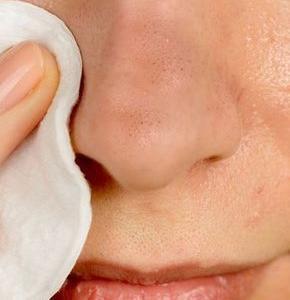 毛孔時常堵塞 真希望有個如毛孔吸塵器一般的單品！