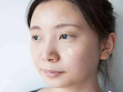 眼袋重是什么原因造成的，女性快速去除眼袋的四個方法