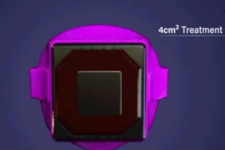 眼部有細紋做1次熱瑪吉 勝過8000斤雅詩蘭黛眼霜