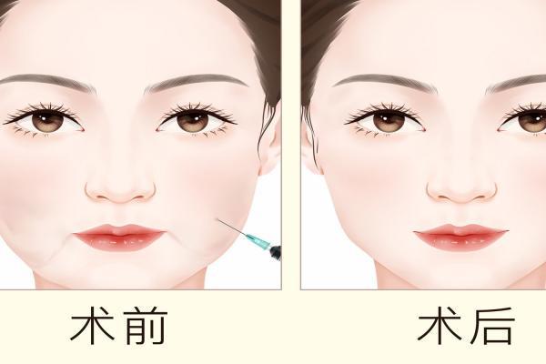 什么美白效果最好-易網健康養生網 什么美白效果最好