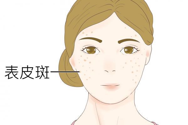 怎樣祛斑快效果好-易網(wǎng)健康<a href=http://www.logojc.com/jkys/ target=_blank class=infotextkey>養(yǎng)生</a>網(wǎng) 怎樣祛斑快效果好