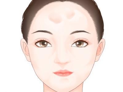 額頭有皺紋怎么回事