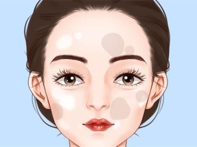 光子祛斑多少錢一次