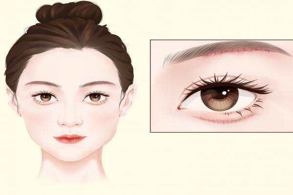 眼袋怎么消除簡單方法