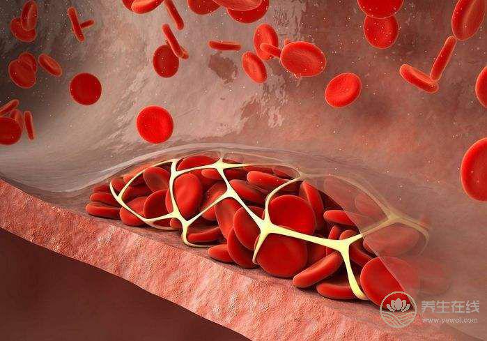 秋季如何預(yù)防血栓形成