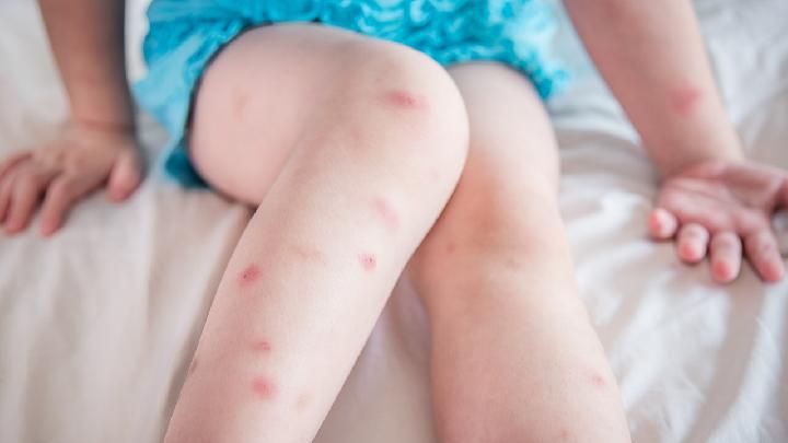 春困應該如何檢查 三種類型春困檢查要留心