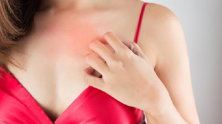 怎么調理花粉過敏體質 花粉過敏主要有三種表現