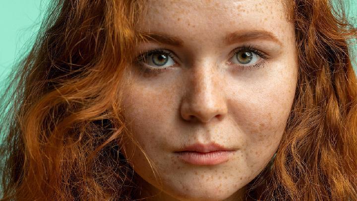 春天花粉過敏怎么治療 7個(gè)處理花粉過敏小竅門很有效