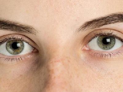 過敏性鼻炎患者吃水果有禁忌 過敏性鼻炎患者可以吃7種水果