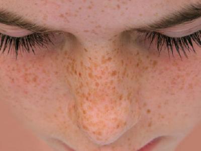 春季養(yǎng)生注意什么事項 春季養(yǎng)生注意防曬溫水洗臉