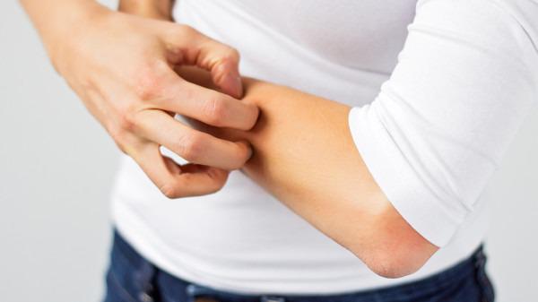 冬天皮膚瘙癢是血燥？ 需要內外調理