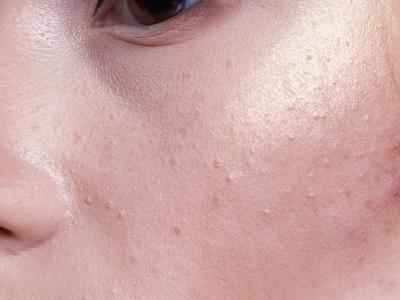 在冬季如何對皮膚進(jìn)行保健