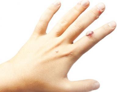 夏季怎么保養(yǎng)皮膚？夏天保護(hù)皮膚的方法有什么