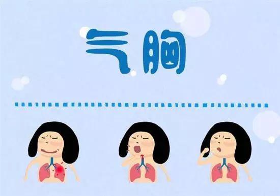 20個(gè)生活中的急救常識(shí) 20個(gè)生活中的急救常識(shí)