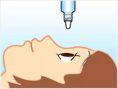 近視手術要多久才能恢復視力?恢復期間會不會影響正常生活? 近視手術要多久才能恢復視力?恢復期間會不會影響正常生活?