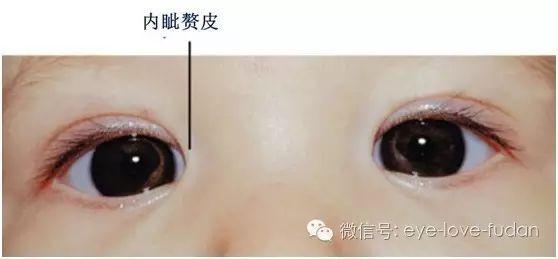 關于眼健康的傳言與真相