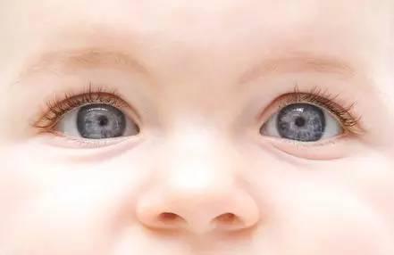 如何才能發現寶寶的視力問題? 如何才能發現寶寶的視力問題?