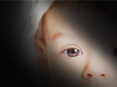 如何有效預防寶寶斜視？