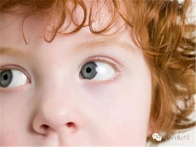 眼睛保健知識有哪些?