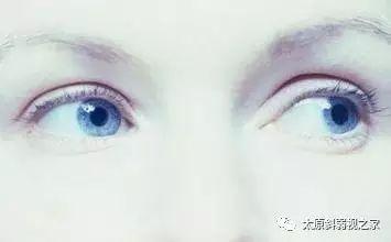 轉眼珠能提高記憶力？還改善視力？