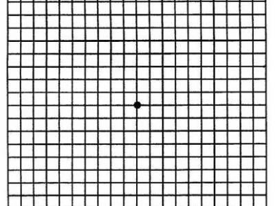 什么是阿姆斯勒表？如何使用？