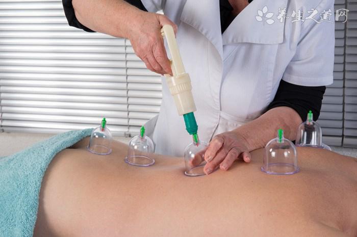 拔火罐能去風濕嗎