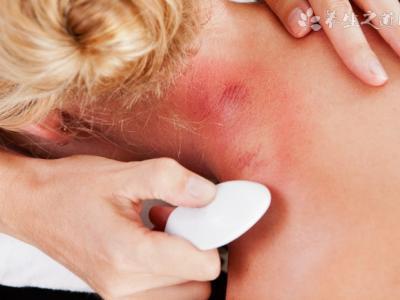 腳底長(zhǎng)繭用什么泡腳