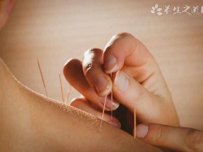 針灸后多久可以洗澡