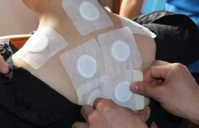 三伏貼必須入伏當(dāng)天貼嗎