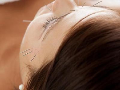 中醫(yī)針灸有效治療青光眼 這幾種方法治青光效果也不錯